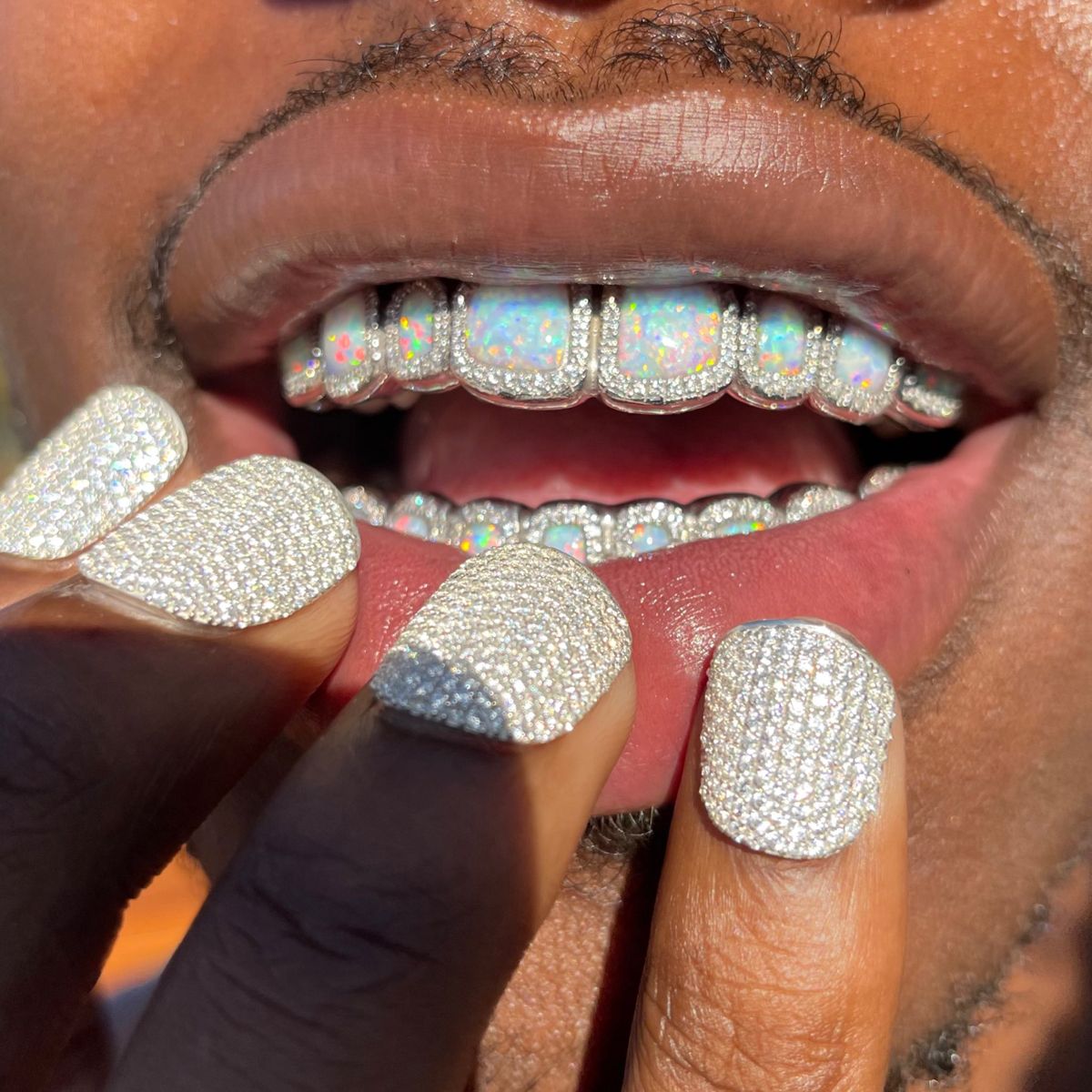 GRILLZ เครื่องประดับฟันสุดจี๊ด ที่สายคนรักฮิปฮอปต้องรู้จัก!